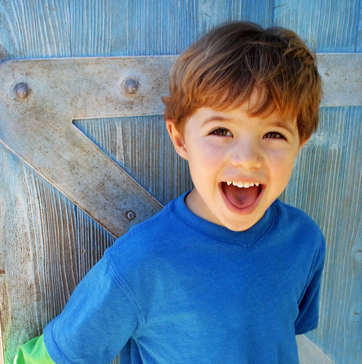 imagen de galeria de 5 elementos